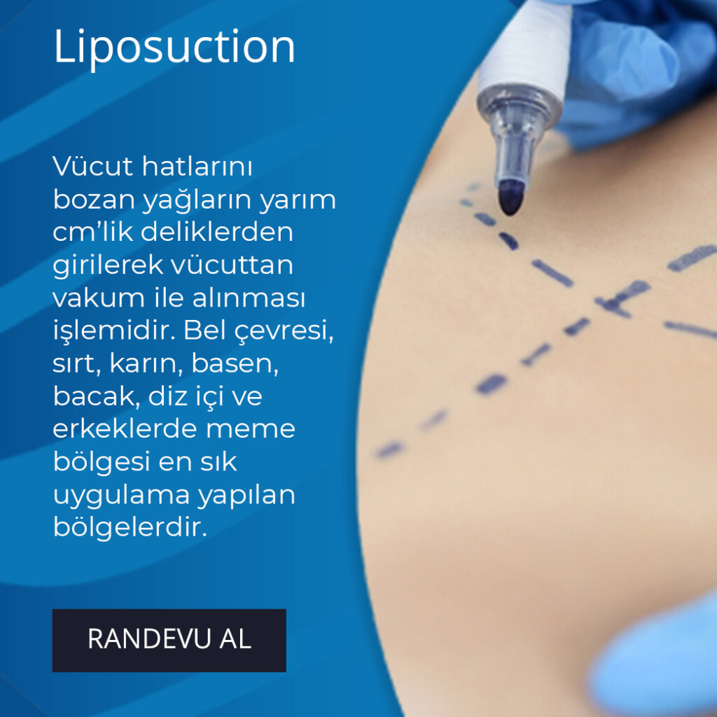 Mersin Liposuction Servisi